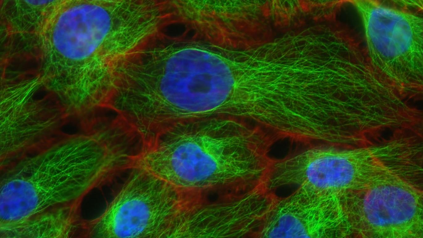 cells
